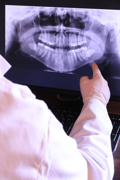 Best Emergency Tooth Extraction in Hugo, OK