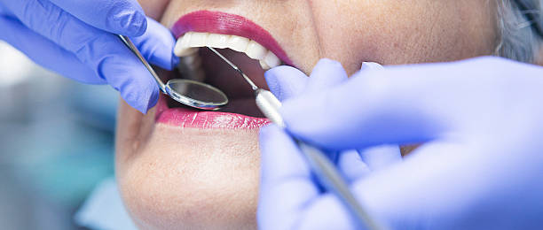 Best Emergency Tooth Extraction in Hugo, OK